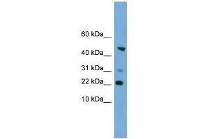WB Suggested Anti-RAC1 Antibody Titration: 0. (RAC1 antibody  (Middle Region))
