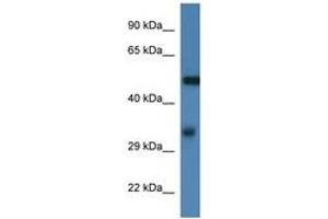 Image no. 1 for anti-Fascin (FSCN1) (AA 93-142) antibody (ABIN6746004) (Fascin antibody  (AA 93-142))