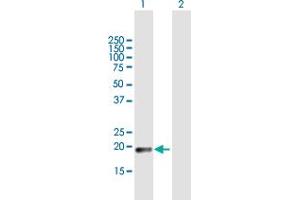 Western Blot analysis of CLEC3A expression in transfected 293T cell line by CLEC3A MaxPab polyclonal antibody. (CLEC3A antibody  (AA 1-197))