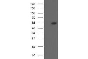 Western Blotting (WB) image for anti-Diphthamide Biosynthesis Protein 2 (DPH2) antibody (ABIN1497891)
