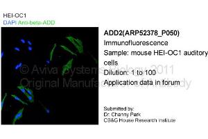 Image no. 2 for anti-Adducin 2 (Beta) (ADD2) (Middle Region) antibody (ABIN406210) (ADD2 antibody  (Middle Region))
