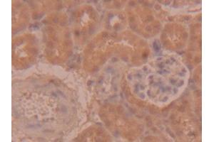 DAB staining on IHC-P; Samples: Mouse Kidney Tissue