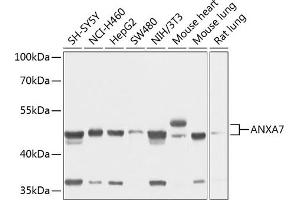 Western blot analysis of extracts of various cell lines, using  antibody (ABIN1678673, ABIN3018016, ABIN3018017 and ABIN6220336) at 1:1000 dilution. (Annexin VII antibody  (AA 237-466))