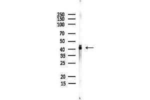 anti-Muscleblind-Like 2 (MBNL2) antibody