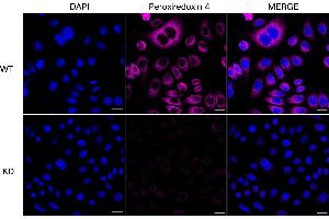 Immunocytochemical staining of HeLa cells using Peroxiredoxin 4 antibody (ABIN7799779), 1:1,000), Top panel: wild-type (WT), Bottom panal: Peroxiredoxin 4 shRNA knockdown (KD). (Recombinant Peroxiredoxin 4 antibody)