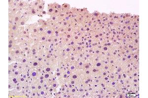 Formalin-fixed and paraffin embedded mouse liver tissue labeled with Anti-CYP27A1 Polyclonal Antibody, Unconjugated (ABIN708911) at 1:200 followed by conjugation to the secondary antibody and DAB staining (CYP27A1 antibody  (AA 321-420))
