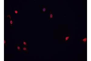 ABIN6266767 staining HeLa cells by IF/ICC. (ATRX antibody  (N-Term))