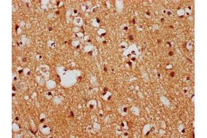 IHC image of ABIN7152731 diluted at 1:400 and staining in paraffin-embedded human brain tissue performed on a Leica BondTM system. (FEZF1 antibody  (AA 1-115))