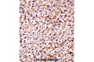Immunohistochemistry (IHC) image for anti-Casein Kinase 1, epsilon (CSNK1E) antibody (ABIN2998172)