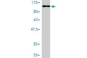 Western Blot detection against Immunogen (92. (TDP1 antibody  (AA 1-608))