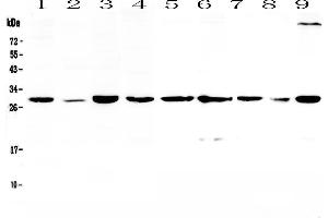 Western blot analysis of 14-3-3 sigma  using anti-14-3-3 sigma  antibody .