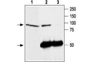 Immunoprecipitation of rat brain lysate: - 1. (TRPC4 antibody  (C-Term, Intracellular))