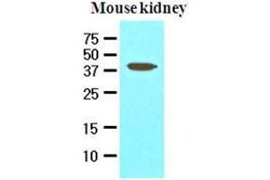 The extracts of mouse kidney (50 ug) were resolved by SDS-PAGE, transferred to nitrocellulose membrane and probed with anti-human PDCD12 (1:1000).
