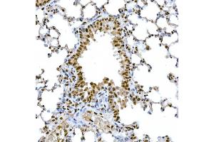 Immunohistochemistry (IHC) image for anti-SNAIL (SNAI1) (AA 1-100) antibody (ABIN1682836)