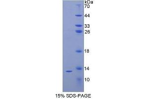 SDS-PAGE (SDS) image for Parathyroid Hormone (PTH) (AA 31-115) protein (His tag) (ABIN1080450)
