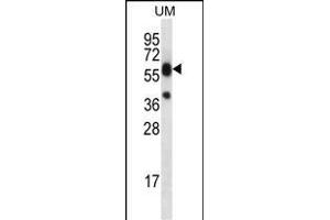 LI Antibody (C-term) (ABIN656461 and ABIN2845745) western blot analysis in uterus tumor cell line lysates (35 μg/lane). (LIPM antibody  (C-Term))