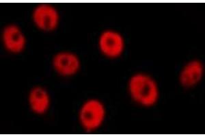 ABIN6277733 staining  Hela cells by IF/ICC. (RAD21 antibody  (C-Term))