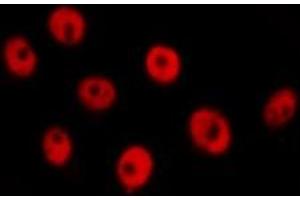 ABIN6277733 staining  Hela cells by IF/ICC. (RAD21 antibody  (C-Term))