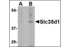 Western blot analysis of Slc35D1 in Daudi lysate with this product at (A) 1 and (B) 2 μg/ml. (SLC35D1 antibody  (C-Term))