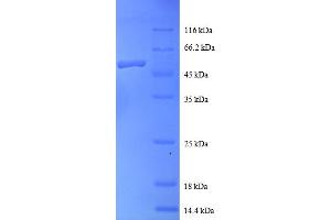 SDS-PAGE (SDS) image for RAB1A, Member RAS Oncogene Family (RAB1A) (AA 2-205) protein (GST tag) (ABIN4975537) (RAB1A Protein (AA 2-205) (GST tag))