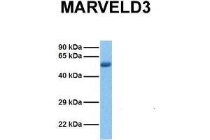 Host:  Rabbit  Target Name:  MARVELD3  Sample Tissue:  Human Lung Tumor  Antibody Dilution:  1. (MARVELD3 antibody  (Middle Region))