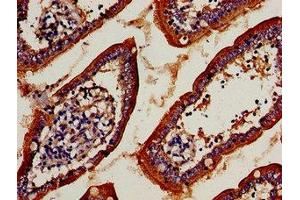 Immunocytochemistry analysis of human small intestine tissue using ABIN7171289 at dilution of 1:100 (TCRb antibody  (AA 22-115))