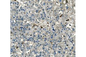 IHC analysis of AKR1D1 using anti-AKR1D1 antibody (ABIN7602741). (AKR1D1 antibody  (C-Term))