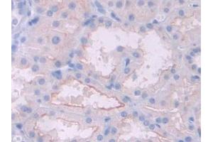 DAB staining on IHC-P; Samples: Human Kidney Tissue (HFE2 antibody  (AA 234-416))