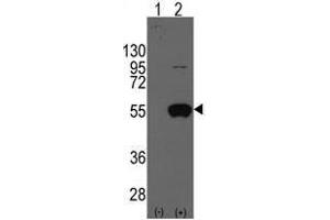Image no. 1 for anti-Aldehyde Dehydrogenase 2 Family (Mitochondrial) (ALDH2) (N-Term) antibody (ABIN356917) (ALDH2 antibody  (N-Term))