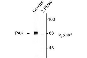 Image no. 1 for anti-P21-Activated Kinase 1 (PAK1) (pThr402) antibody (ABIN372696) (PAK1 antibody  (pThr402))