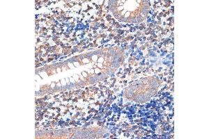 Immunohistochemistry of paraffin-embedded human appendix using CRMP5/DPYSL5 Rabbit mAb (ABIN7266774) at dilution of 1:100 (40x lens). (DPYSL5 antibody)