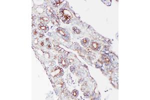 Immunohistochemistry (IHC) image for anti-Proprotein Convertase Subtilisin/kexin Type 9 (PCSK9) (AA 671-687), (C-Term) antibody (ABIN3042887)