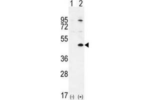 Western blot analysis of TGIF1 (arrow) using rabbit polyclonal TGIF1 Antibody (Center L223) . (TGIF1 antibody  (Middle Region))