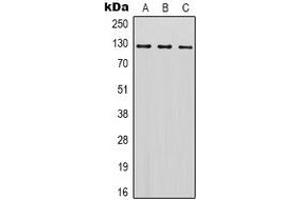 Western blot analysis of SREBP1 expression in Hela (A), Jurkat (B), NIH3T3 (C) whole cell lysates. (SREBF1 antibody)