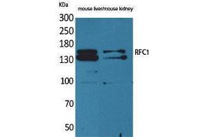 Western Blotting (WB) image for anti-Replication Factor C (Activator 1) 1, 145kDa (RFC1) (Internal Region) antibody (ABIN3187830)