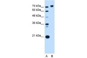 PTPRN antibody used at 0. (PTPRN antibody  (Middle Region))