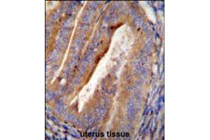 OGN Antibody immunohistochemistry analysis in formalin fixed and paraffin embedded human uterus tissue followed by peroxidase conjugation of the secondary antibody and DAB staining.