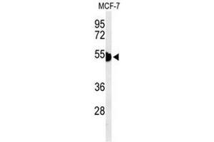 Western blot analysis of KRT1 Antibody (Center) in MCF-7 cell line lysates (35µg/lane). (Cytokeratin 1 antibody  (Middle Region))