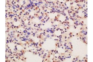 Formalin-fixed and paraffin embedded mouse lung labeled with Rabbit Anti-ASCL2 Polyclonal Antibody, Unconjugated  at 1:200 followed by conjugation to the secondary antibody and DAB staining (ASCL2 antibody)