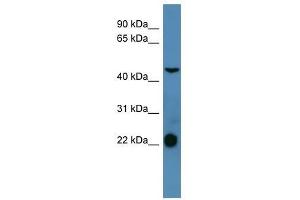 SSTR1 antibody used at 0. (SSTR1 antibody  (C-Term))