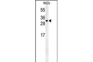 TM2D3 Antibody (N-term) (ABIN651559 and ABIN2840300) western blot analysis in WiDr cell line lysates (35 μg/lane). (TM2D3 antibody  (N-Term))