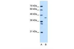 Image no. 1 for anti-Mitochondrial Carrier 1 (MTCH1) (C-Term) antibody (ABIN6738296) (MTCH1 antibody  (C-Term))