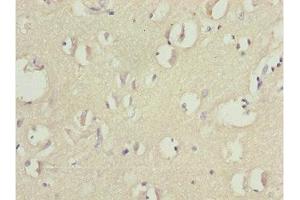 Immunohistochemistry of paraffin-embedded human brain tissue using ABIN7165175 at dilution of 1:100 (TNRC5 antibody  (AA 31-278))
