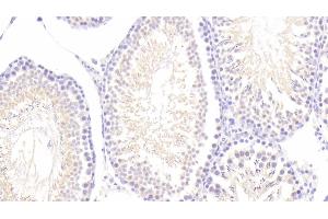 Detection of MAP2 in Rat Testis Tissue using Polyclonal Antibody to Microtubule Associated Protein 2 (MAP2) (MAP2 antibody  (AA 1459-1718))