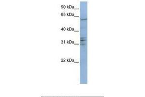 Image no. 1 for anti-Centromere Protein B (CENPB) (AA 506-555) antibody (ABIN6738799) (CENPB antibody  (AA 506-555))