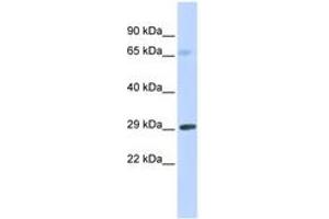 Image no. 1 for anti-Fc Fragment of IgE Receptor Ia (FCER1A) (AA 144-193) antibody (ABIN6743351) (Fc epsilon RI/FCER1A antibody  (AA 144-193))