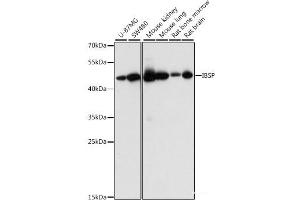 Western blot analysis of extracts of various cell lines using IBSP Polyclonal Antibody at dilution of 1:1000.