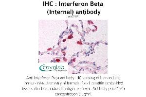Image no. 1 for anti-Interferon, beta 1, Fibroblast (IFNB1) (Internal Region) antibody (ABIN1735973) (IFNB1 antibody  (Internal Region))