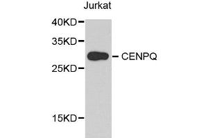 Western blot analysis of extract of various cells, using CENPQ antibody. (CENPQ antibody)