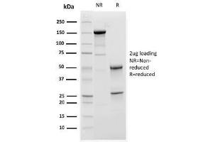 SDS-PAGE Analysis Purified C1QA Mouse Monoclonal Antibody (C1QA/2952). (C1QA antibody  (AA 104-237))